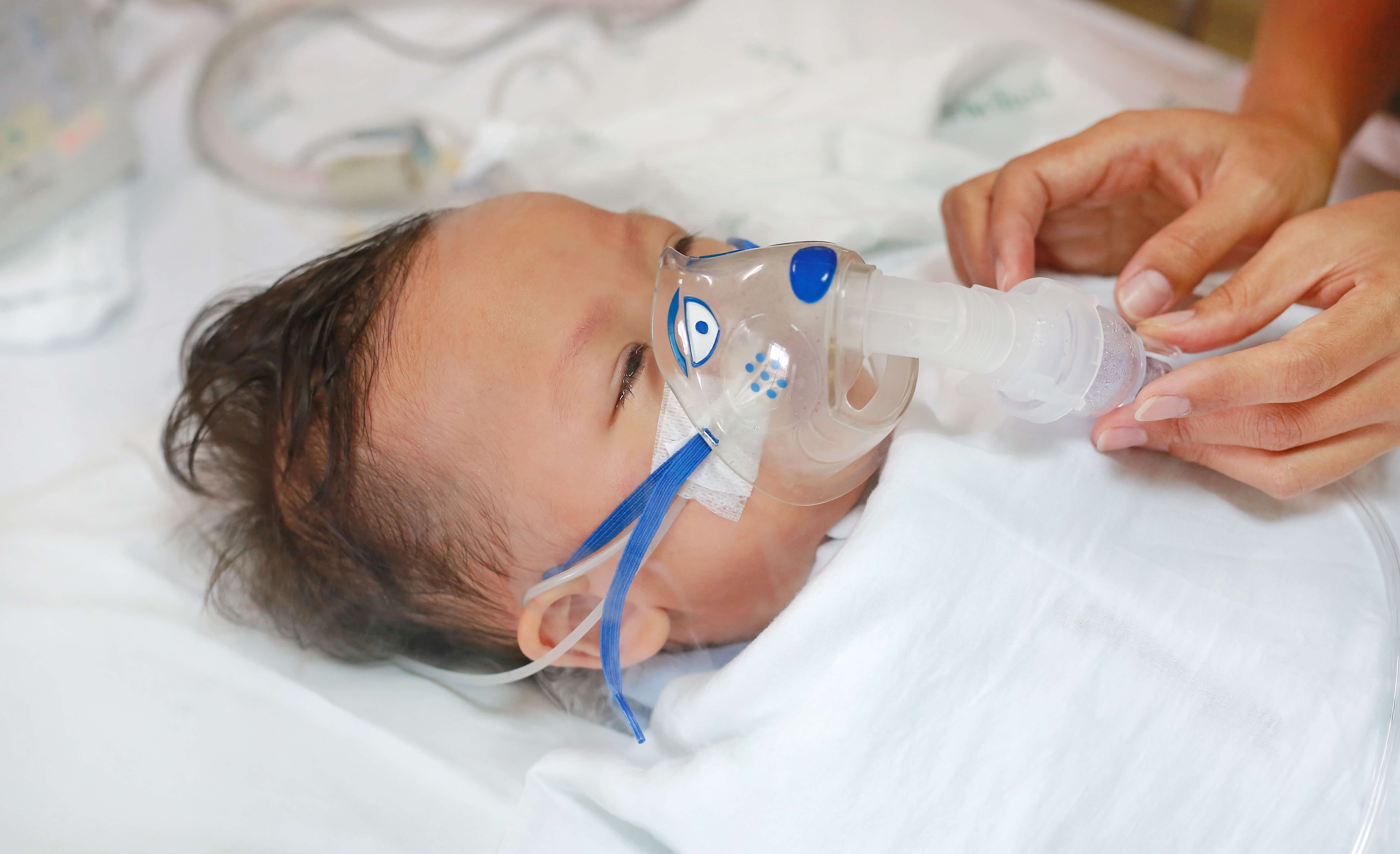 baby with oxygen mask